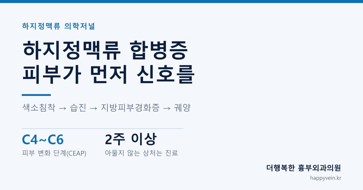 하지정맥류 진행에 따른 다리 피부 변화 단계 도해 — 색소침착, 습진, 지방피부경화증, 궤양