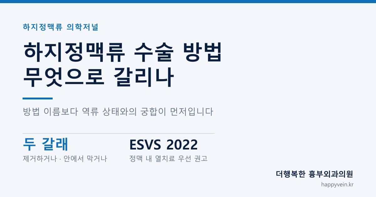 하지정맥류 수술 방법 비교 — 발거술, 레이저, 고주파, 접착제 치료의 원리 도해
